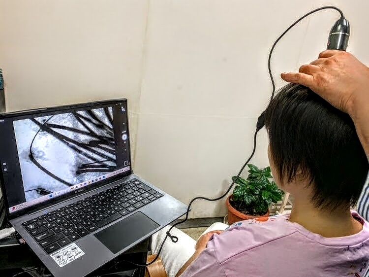 ブログ